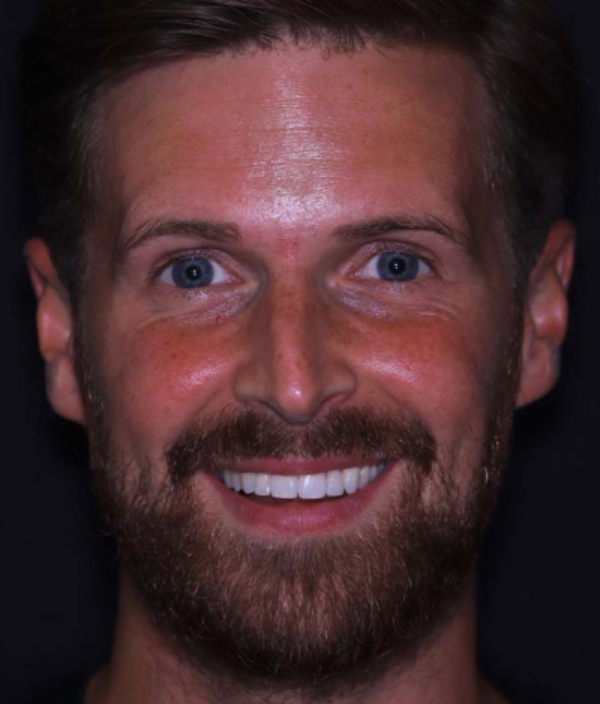 face - Dr Nina Shaffie