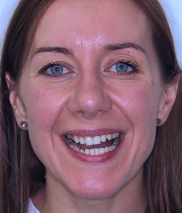 face - Dr Nina Shaffie