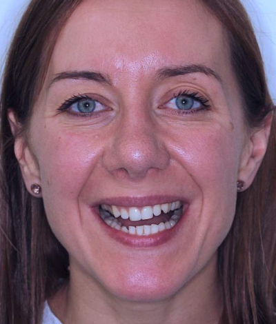 face - Dr Nina Shaffie