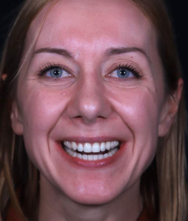 face - Dr Nina Shaffie