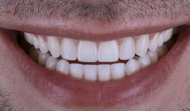 face - Dr Nina Shaffie