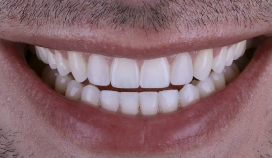 face - Dr Nina Shaffie