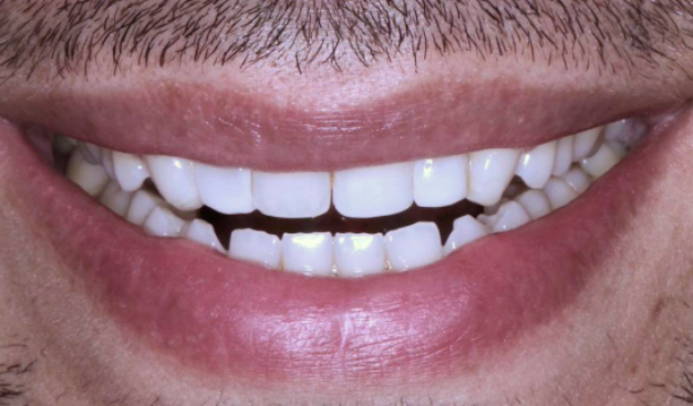 face - Dr Nina Shaffie