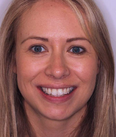 face - Dr Nina Shaffie