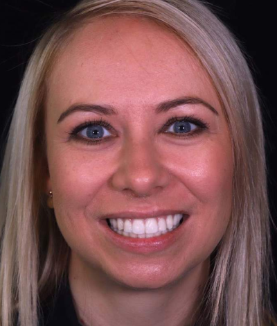 face - Dr Nina Shaffie