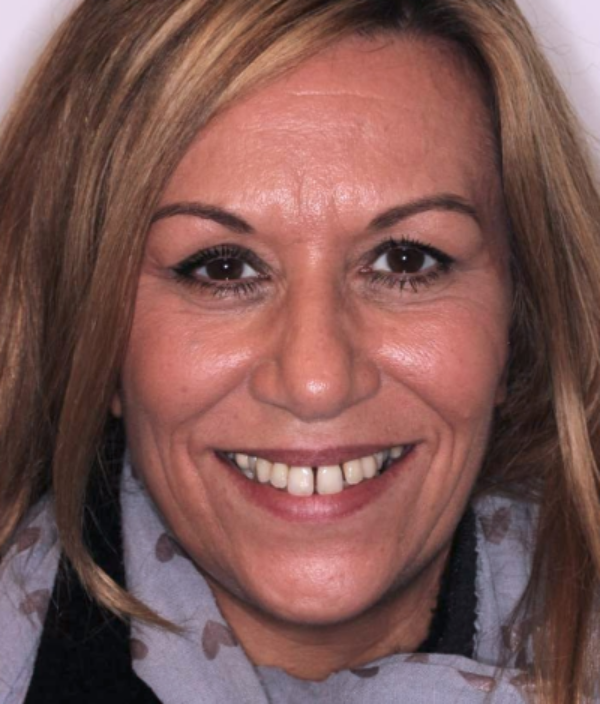 face - Dr Nina Shaffie