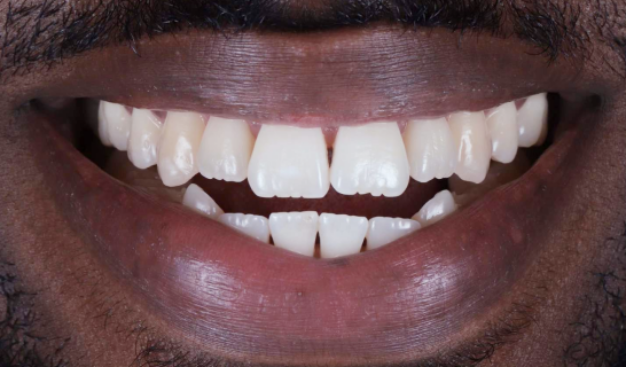 face - Dr Nina Shaffie