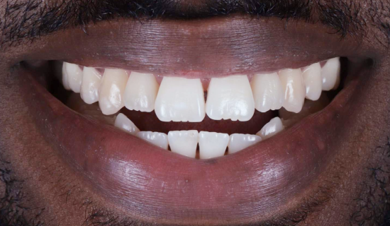 face - Dr Nina Shaffie