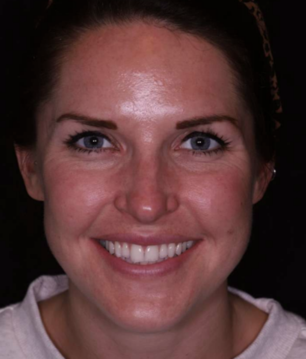 face - Dr Nina Shaffie