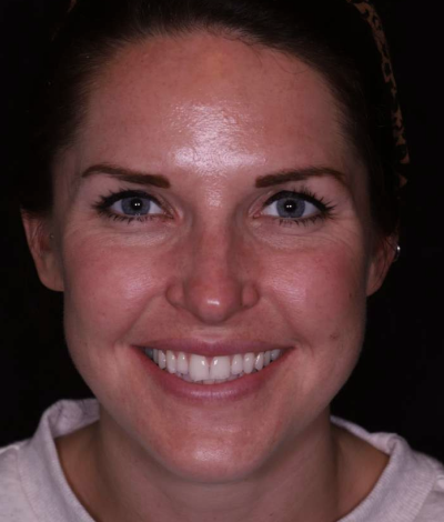 face - Dr Nina Shaffie