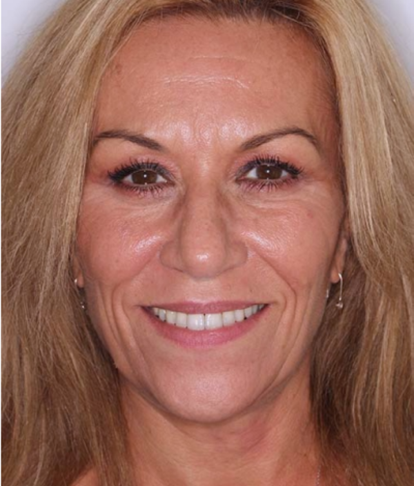 face - Dr Nina Shaffie