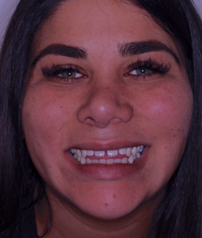 face - Dr Nina Shaffie