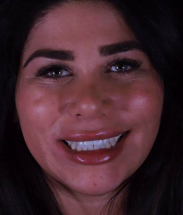 face - Dr Nina Shaffie