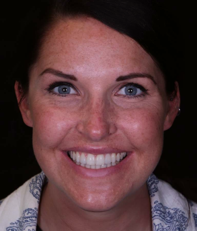 face - Dr Nina Shaffie