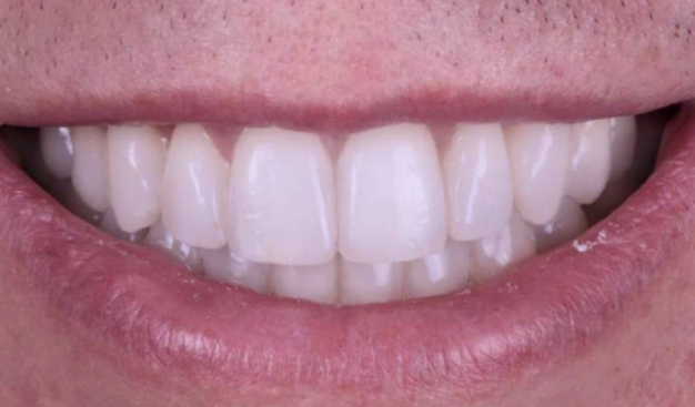 face - Dr Nina Shaffie