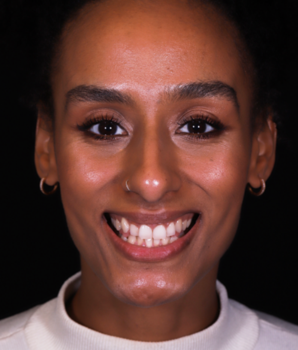 face - Dr Nina Shaffie