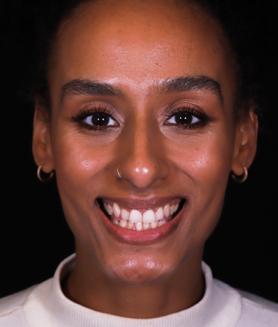 face - Dr Nina Shaffie