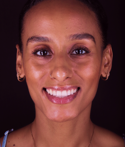 face - Dr Nina Shaffie