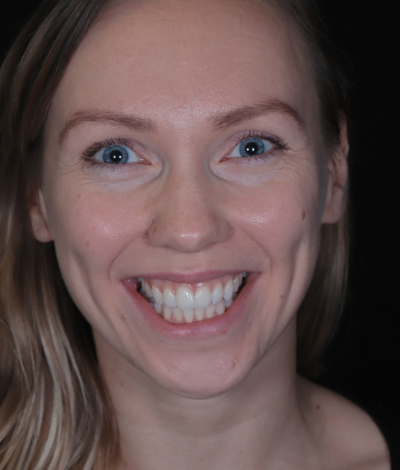 face - Dr Nina Shaffie