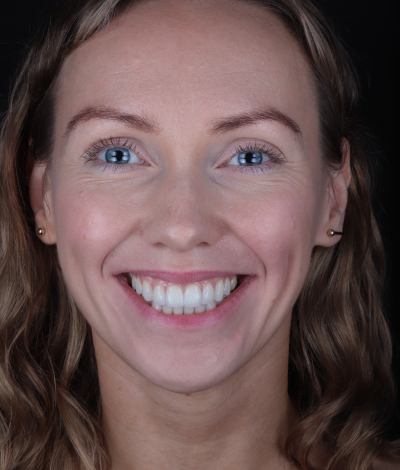 face - Dr Nina Shaffie