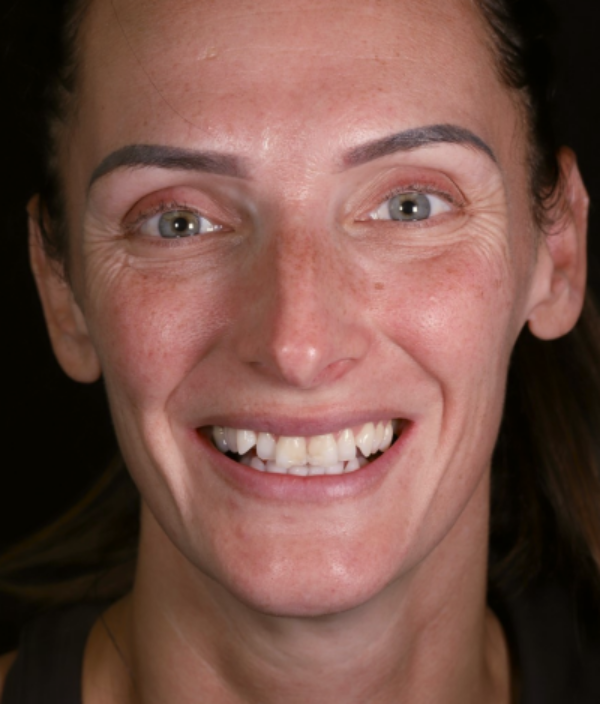 face - Dr Nina Shaffie