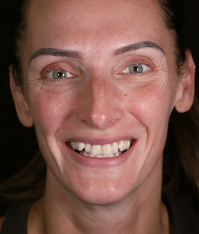 face - Dr Nina Shaffie