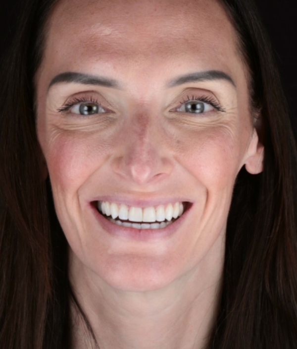 face - Dr Nina Shaffie