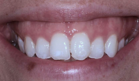 face - Dr Nina Shaffie