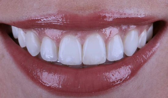 face - Dr Nina Shaffie