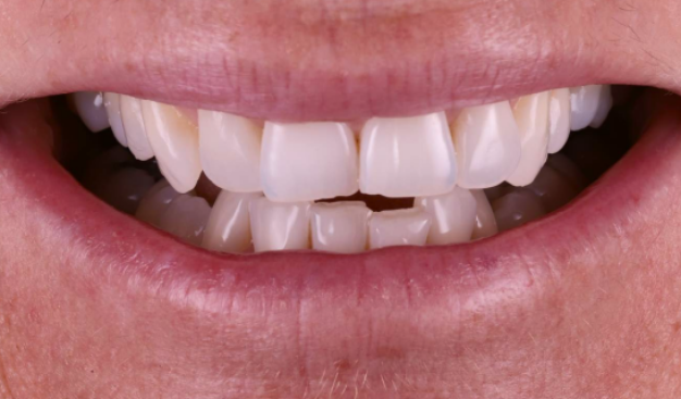 face - Dr Nina Shaffie