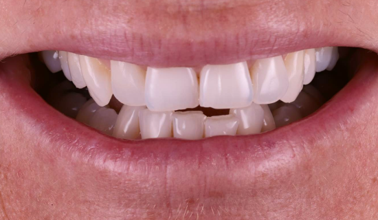 face - Dr Nina Shaffie