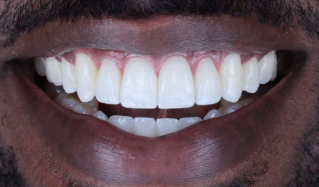 face - Dr Nina Shaffie