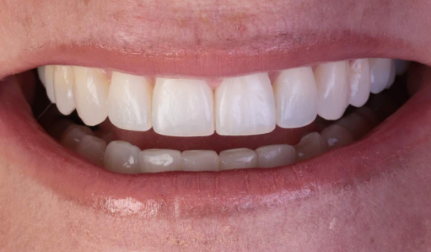 face - Dr Nina Shaffie