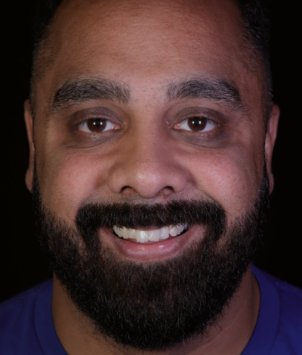 face - Dr Nina Shaffie