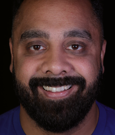 face - Dr Nina Shaffie