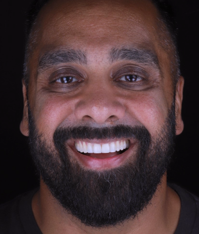 face - Dr Nina Shaffie