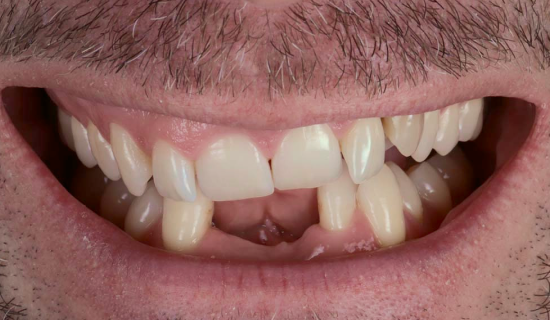 face - Dr Nina Shaffie