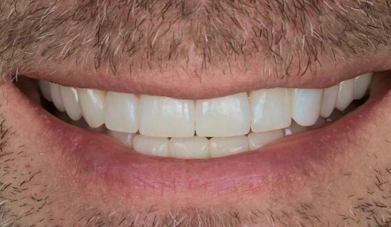 face - Dr Nina Shaffie