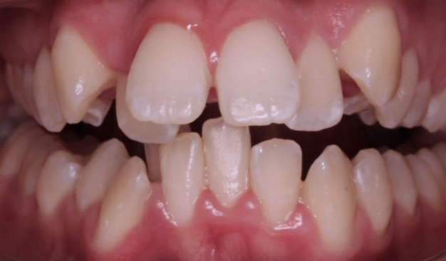 face - Dr Nina Shaffie