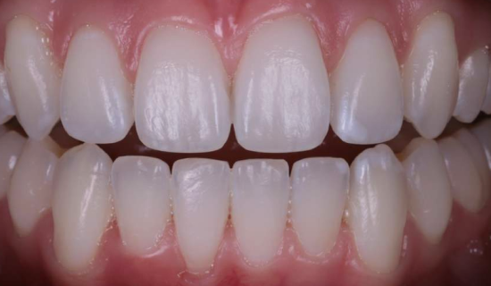 face - Dr Nina Shaffie