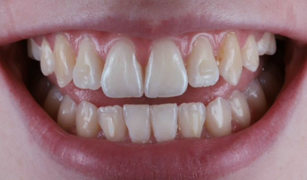 face - Dr Nina Shaffie