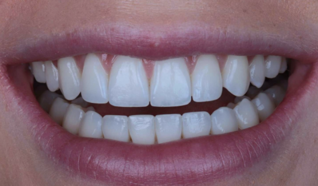 face - Dr Nina Shaffie