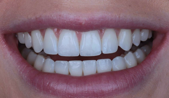 face - Dr Nina Shaffie