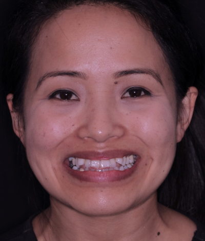 face - Dr Nina Shaffie