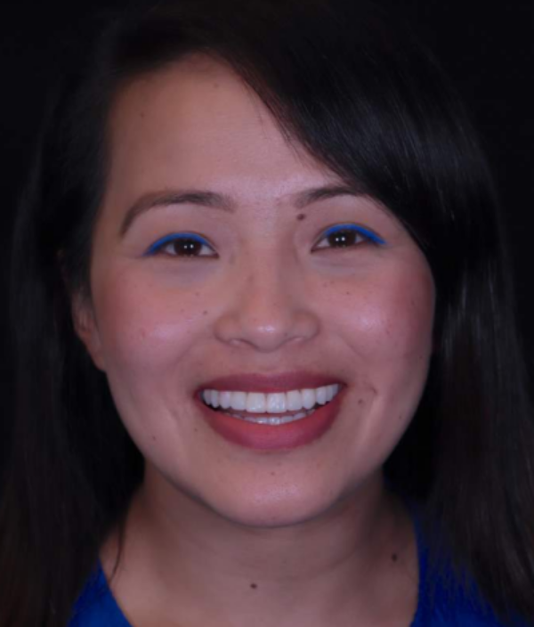 face - Dr Nina Shaffie