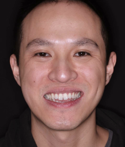 face - Dr Nina Shaffie