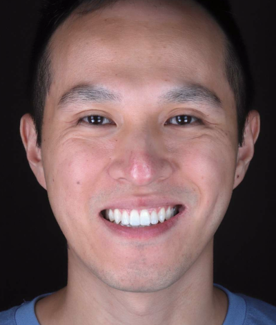 face - Dr Nina Shaffie