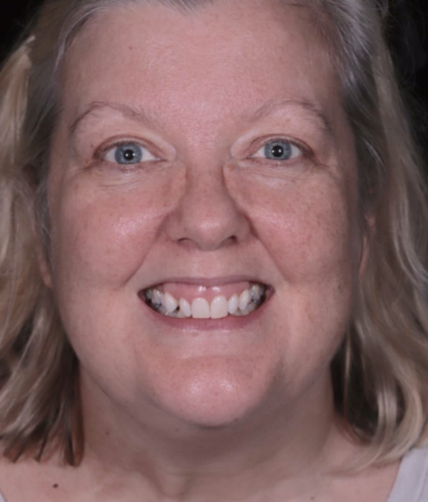 face - Dr Nina Shaffie