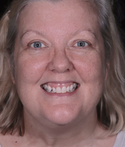 face - Dr Nina Shaffie