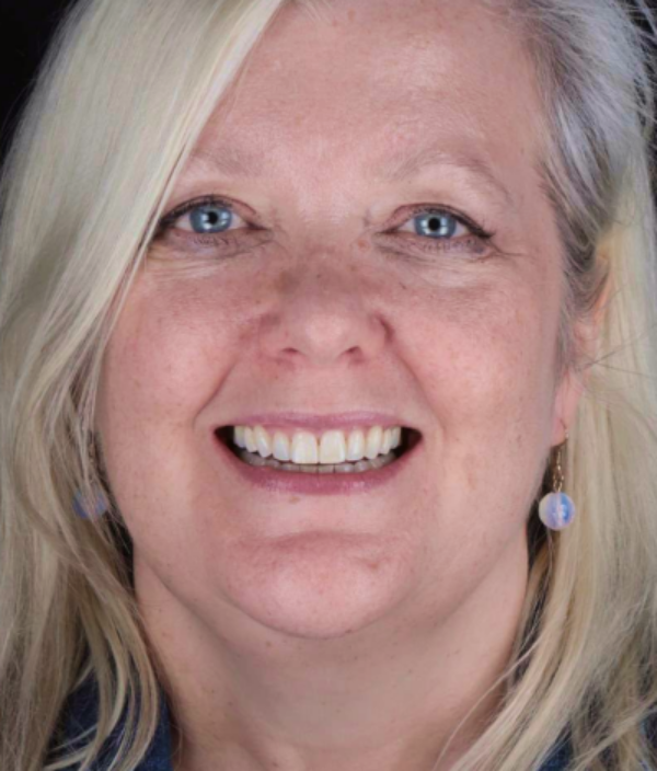 face - Dr Nina Shaffie